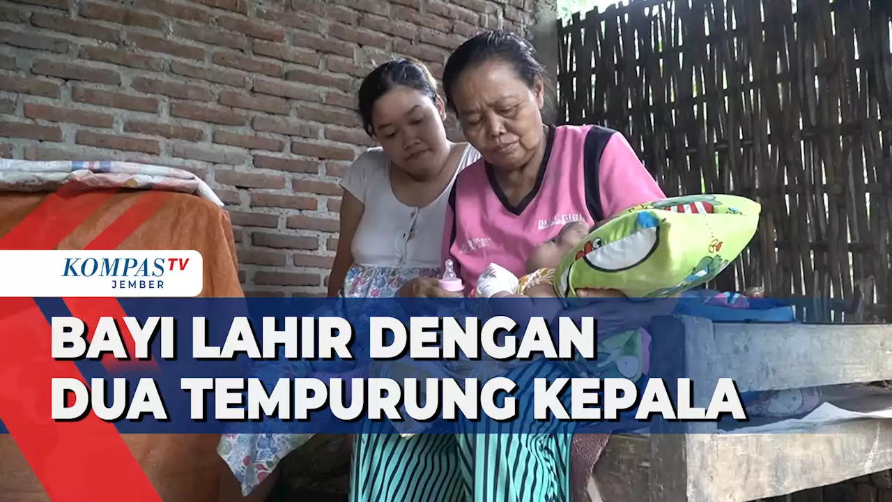 Bayi dengan Dua Tempurung Kepala, Butuh Bantuan Pengobatan