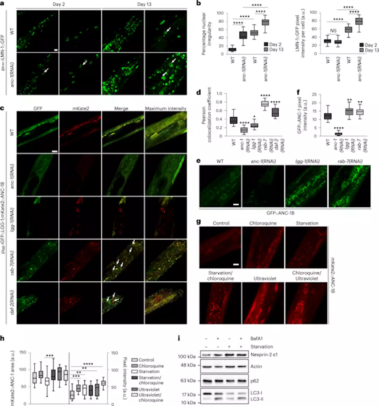 Nucleophagy delays aging and preserves germline immortality - Nature Aging