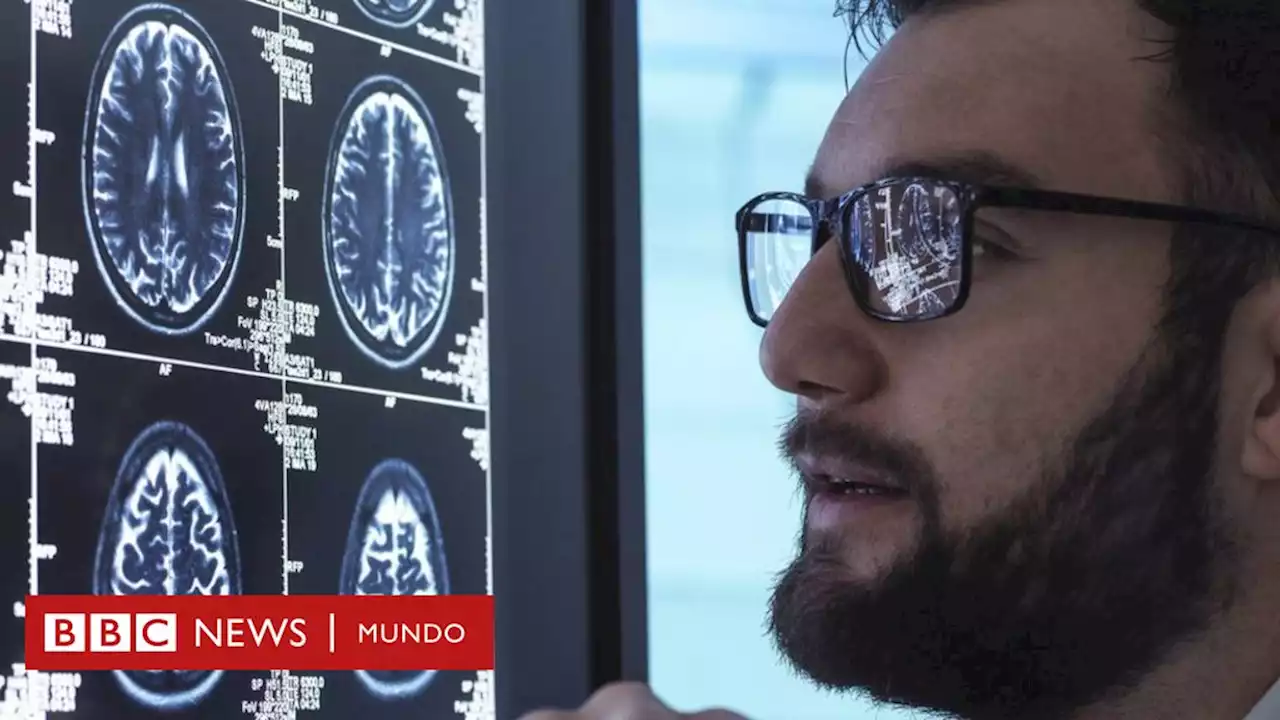 El medicamento aclamado como un avance trascendental en la lucha contra el alzheimer - BBC News Mundo