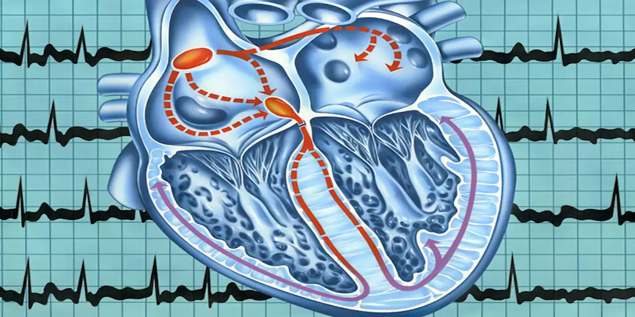 Rhythm Control Strategies in Atrial Fibrillation to Prevent Recurrence: Where Are We Today?