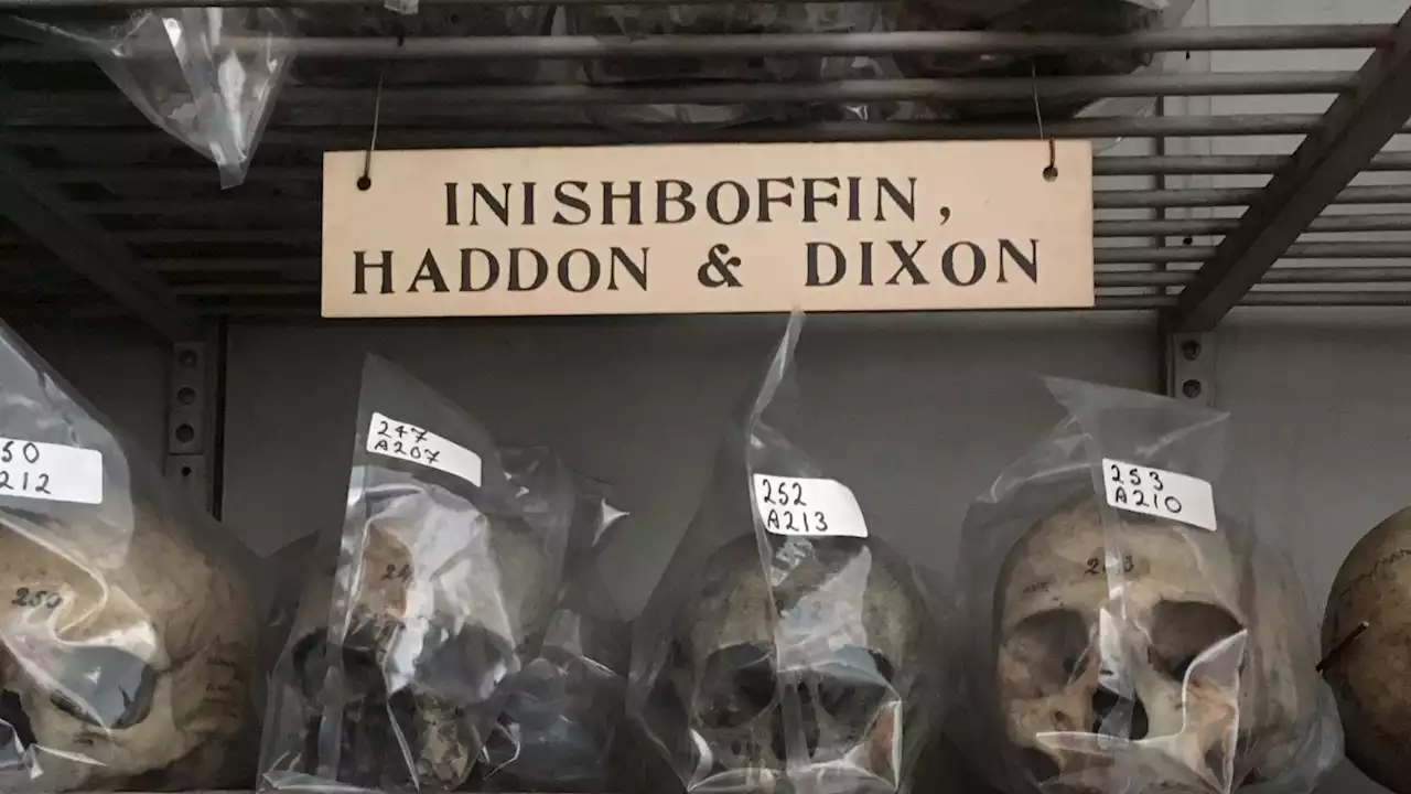 Trinity College Dublin faces islanders' demands to return 400-year-old skulls stolen by 'men of science'