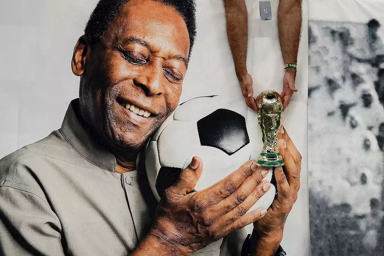 Arsène Wenger asegura que Pelé está bien y fuera de peligro