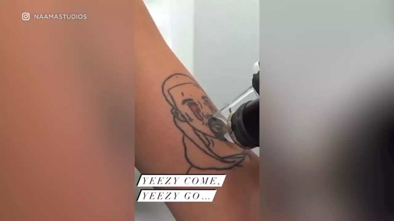 This tattoo removal studio will laser off your Kanye West tattoo for free