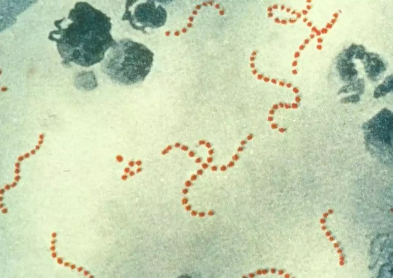 Strep A outbreak: Seventh child dies as scarlet fever outbreaks soar