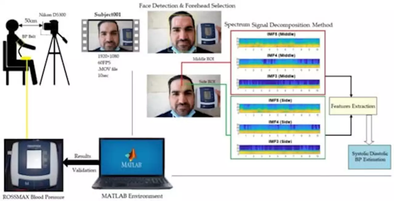 Contactless Blood Pressure Estimation System Using a Computer Vision System