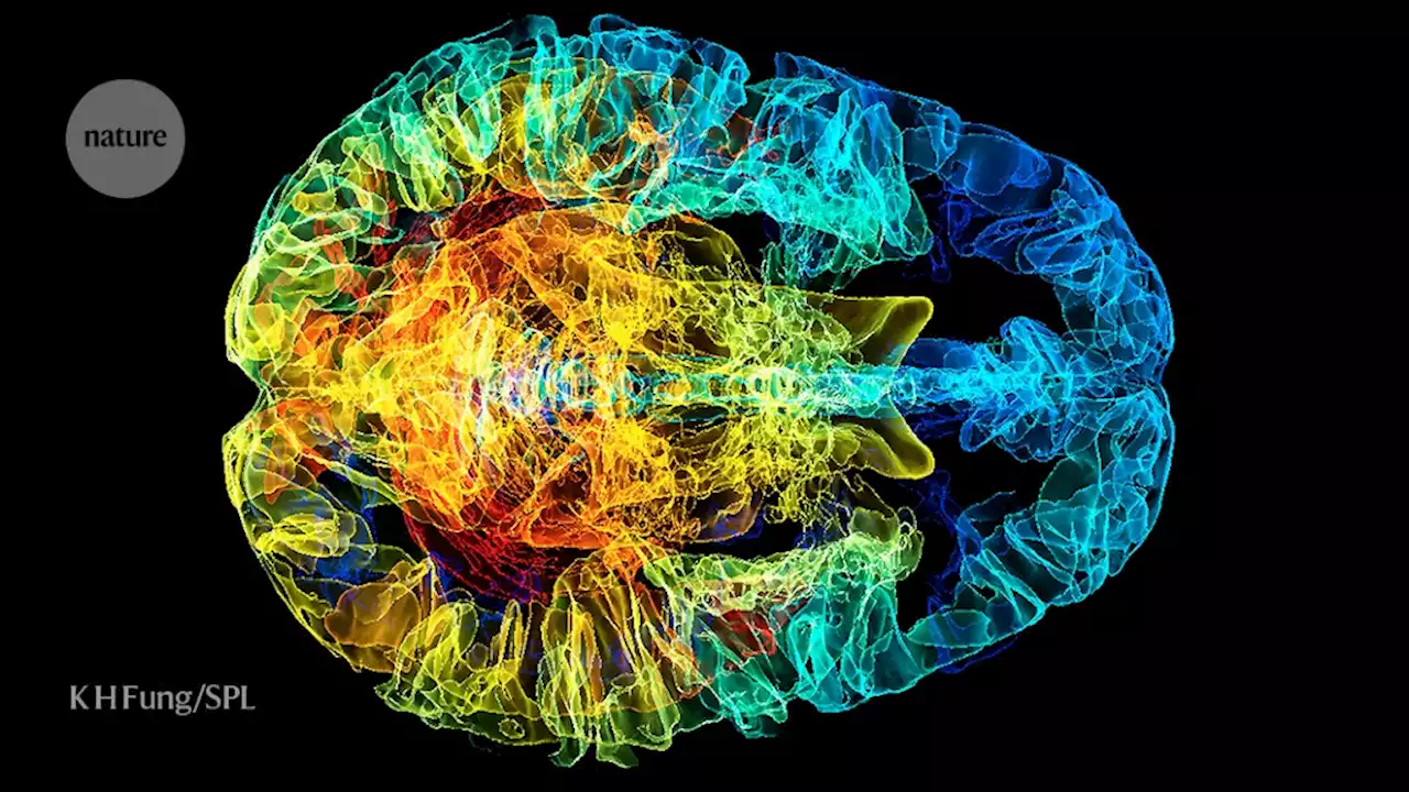 Severe COVID could cause markers of old age in the brain