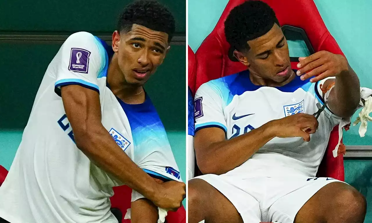 Bellingham cuts bandage off arm after England star is subbed in win over Senegal