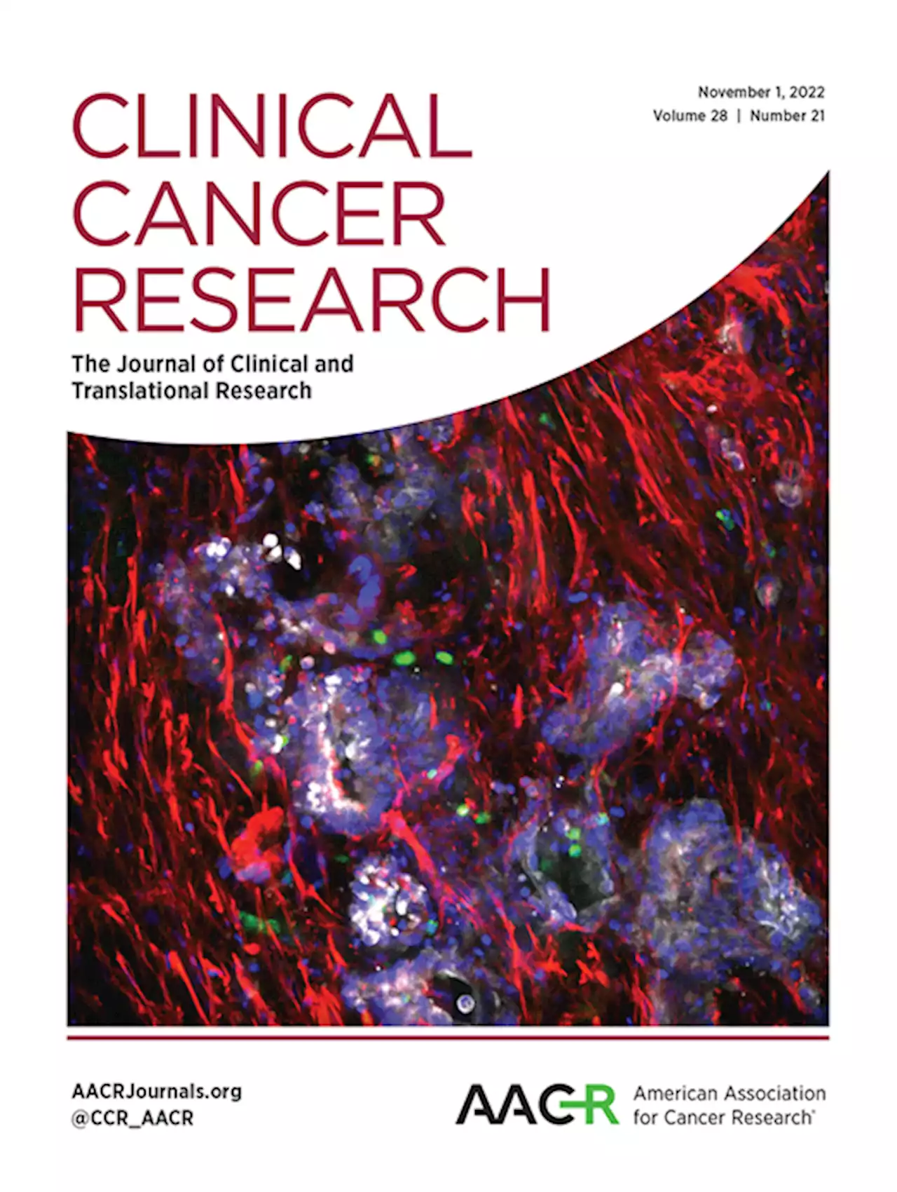 p53 Inhibits Bmi-1-driven Self-Renewal and Defines Salivary Gland Cancer Stemness