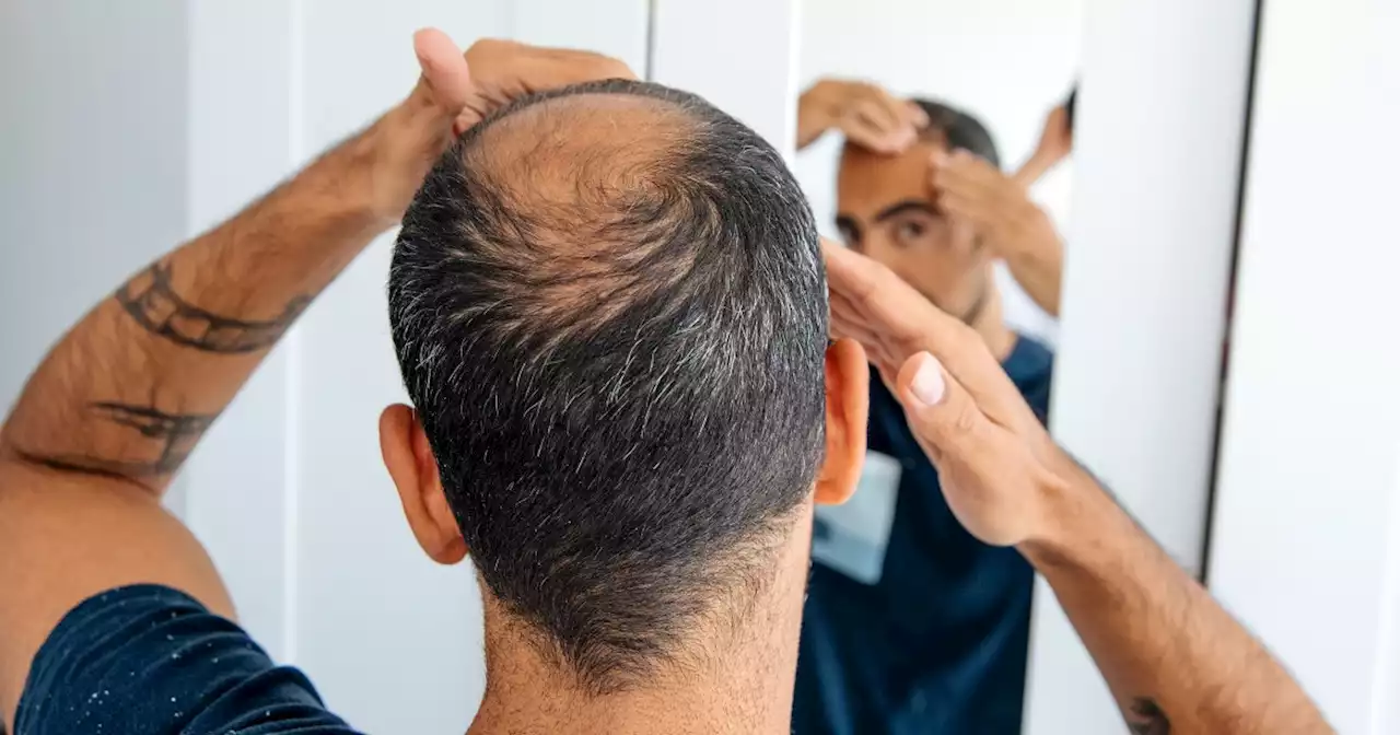 These natural hair loss supplements may actually work, study finds