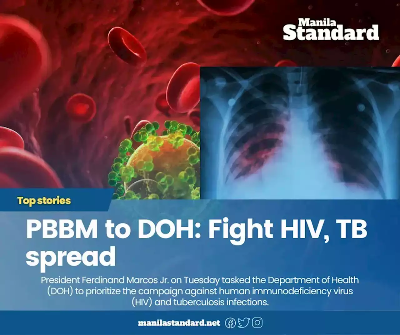 PBBM to DOH: Fight HIV, TB spread