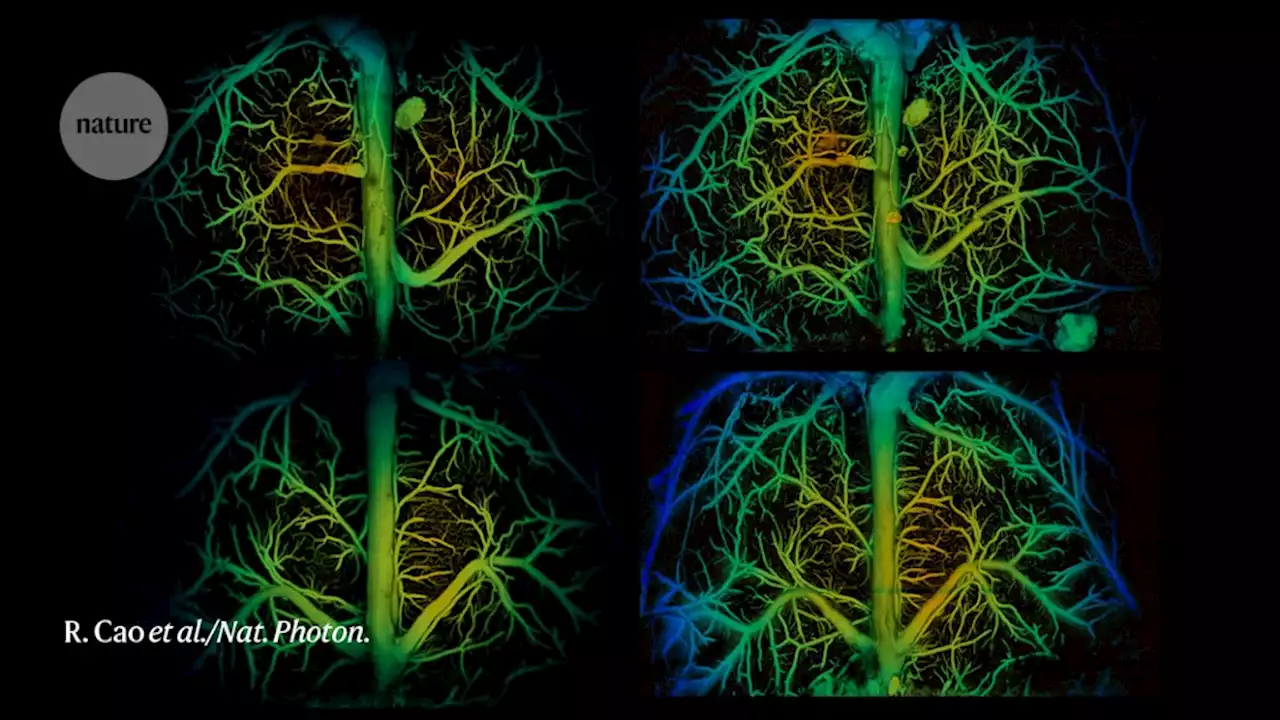 Sharp laser beam reveals internal organs in stunning 3D