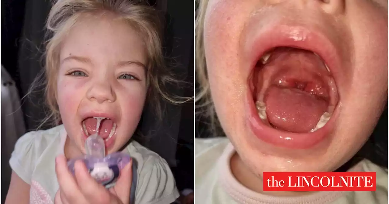 Toddler diagnosed with Strep A: Lincoln mum shares experience