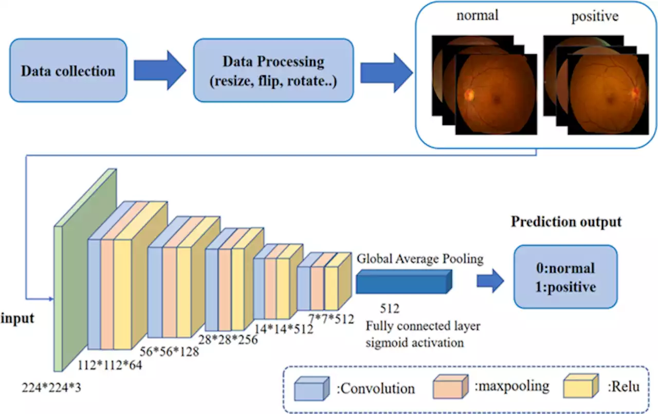 Artificial intelligence to distinguish retinal vein occlusion patients using color fundus photographs - Eye