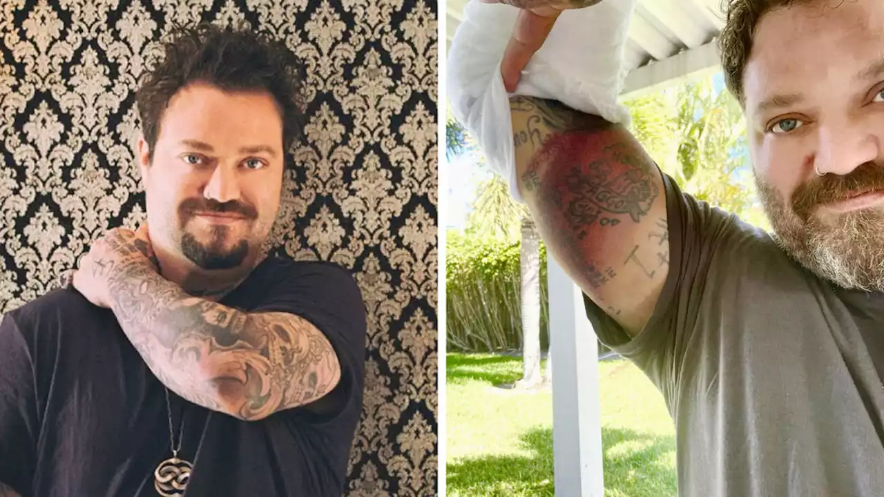 Jackass star Bam Margera 'fighting pneumonia and on ventilator after positive covid test in hospital'