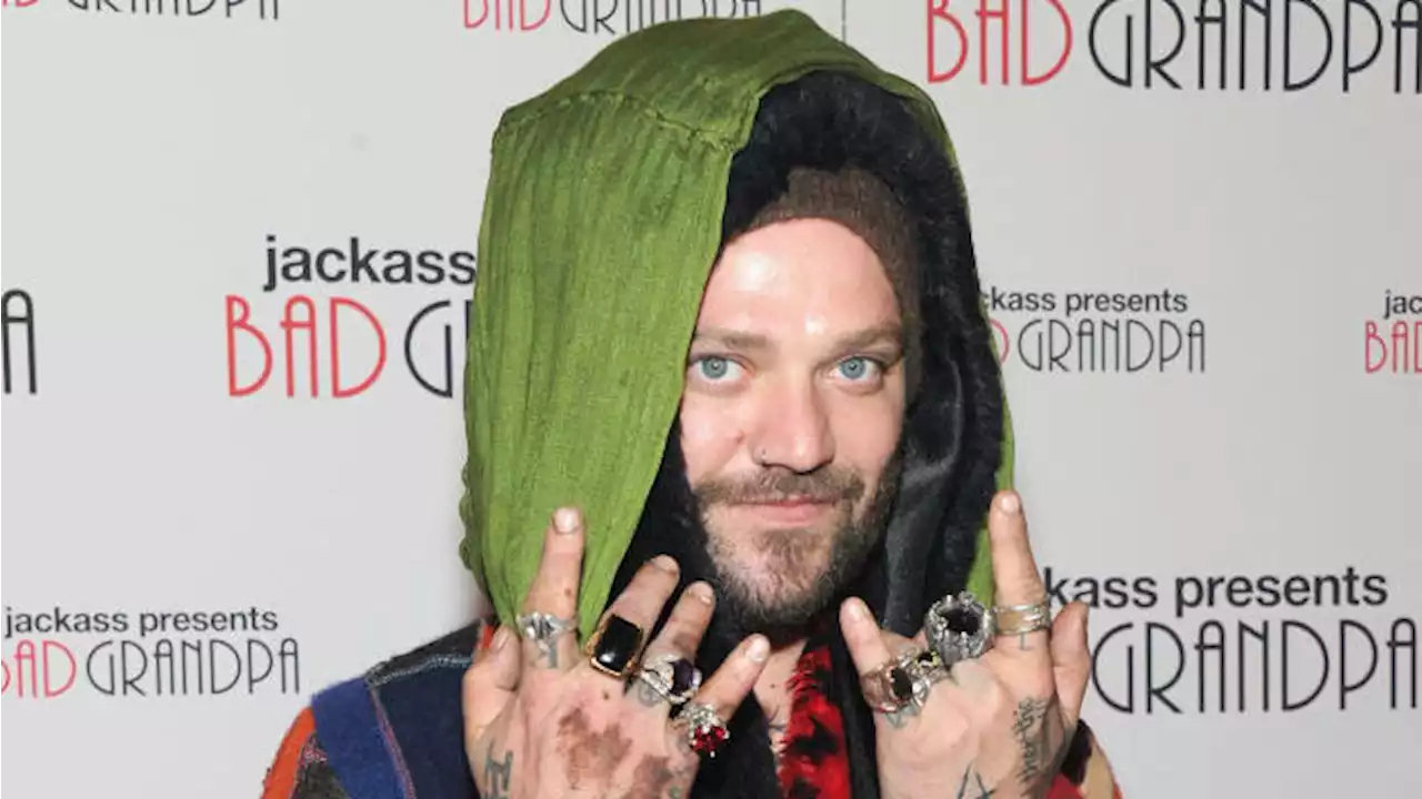 ‘Jackass’ Star Bam Margera on Ventilator With Pneumonia: TMZ