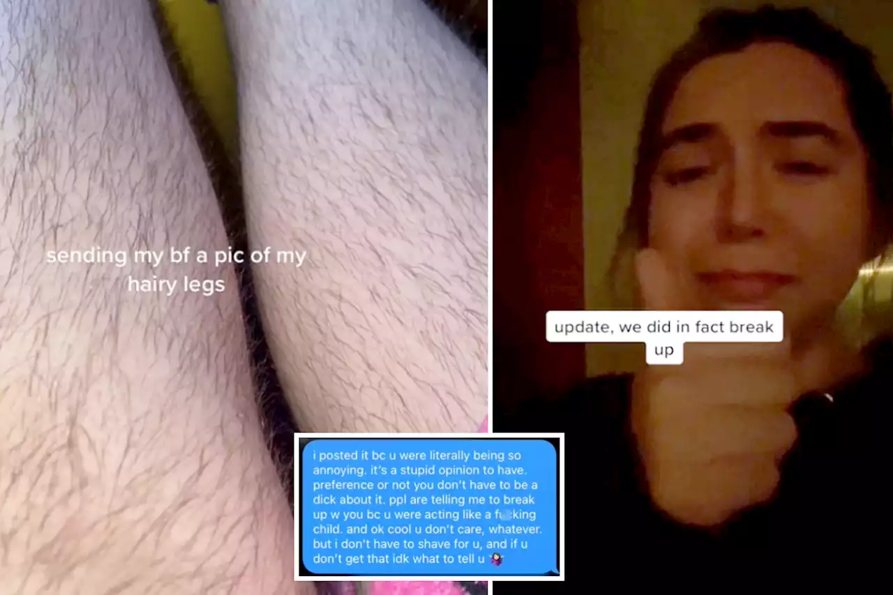 Woman outs boyfriend’s hairy-leg hate in epic TikTok battle