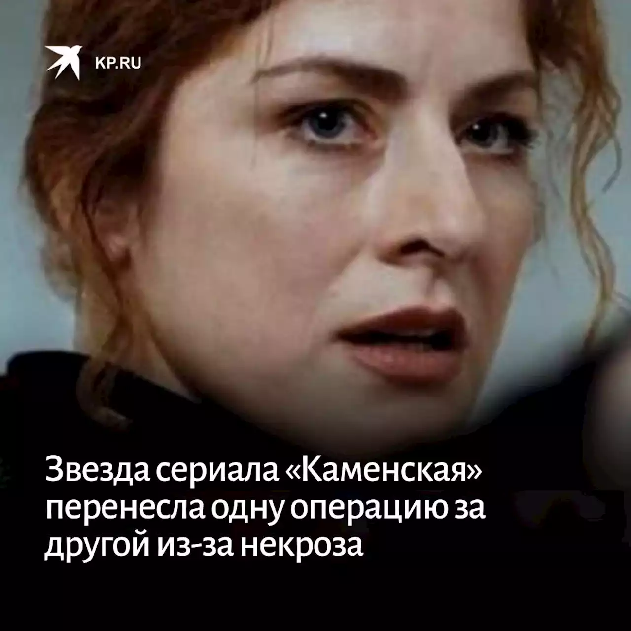 Звезда сериала «Каменская» перенесла одну операцию за другой из-за некроза