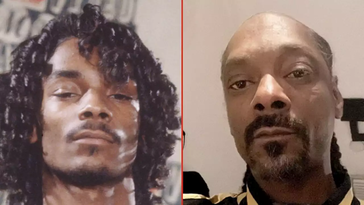 Snoop Dogg -- Good Genes or Good Docs?!