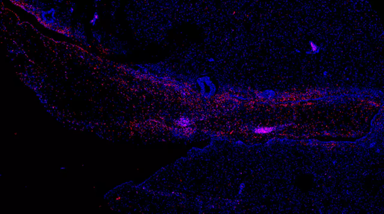 Ebola virus persistence and disease recrudescence in the brains of antibody-treated nonhuman primate survivors