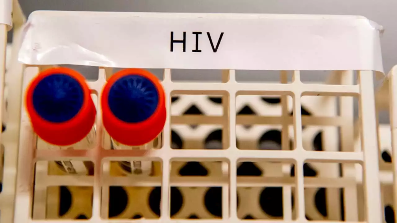 Woman appears to be cured of HIV after using new treatment, NIH says