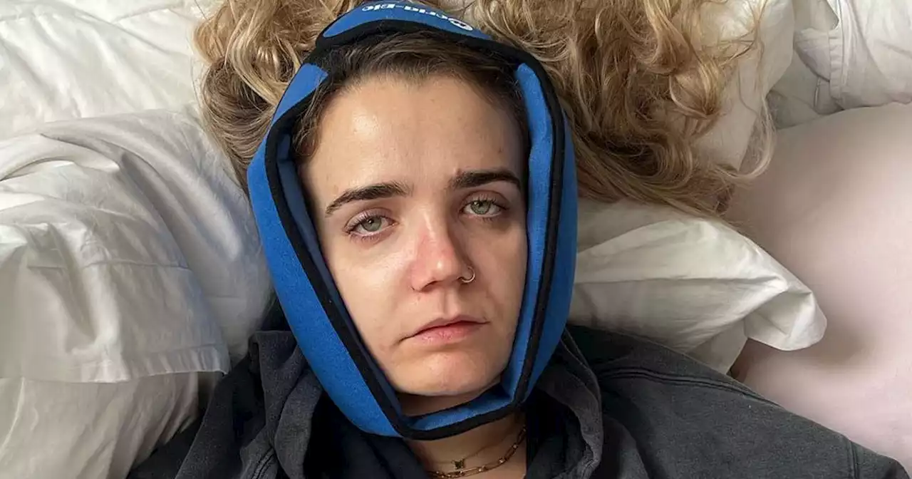 Jeremy Clarkson's daughter Emily gets screws removed from broken jaw