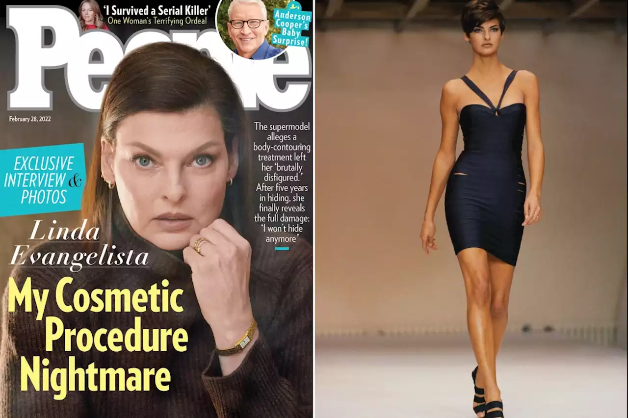 Linda Evangelista shares first photos of body since botched cosmetic procedure