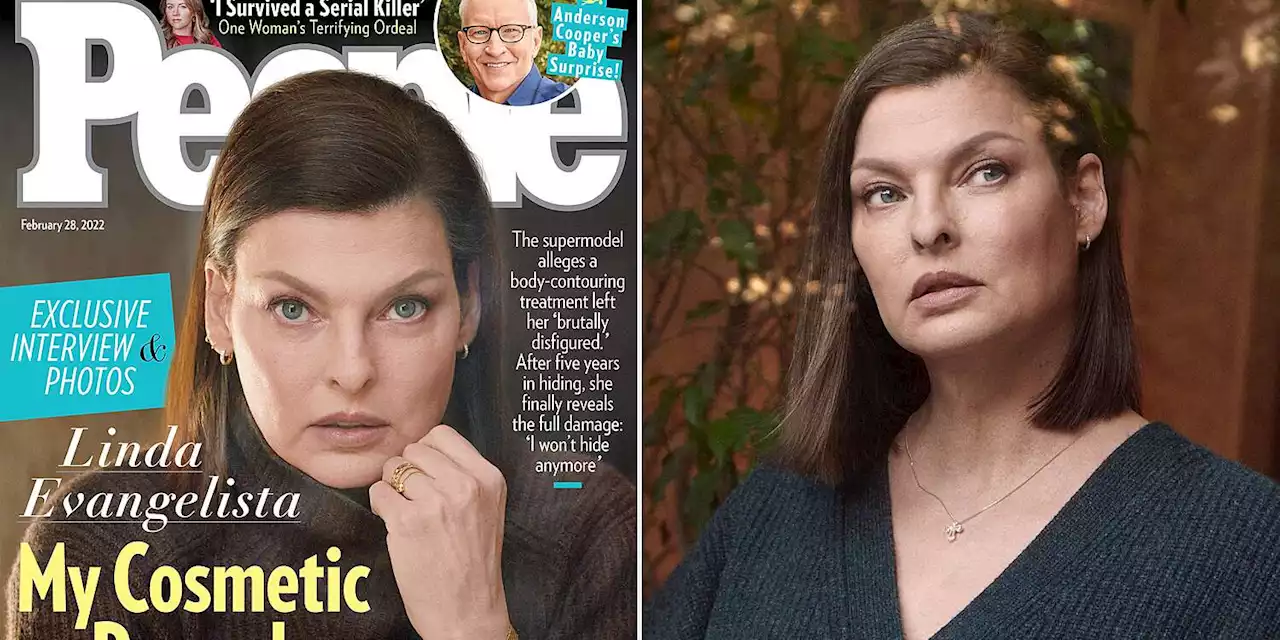 Linda Evangelista Shares First Photos of Her Body Since Fat-Freezing Nightmare: 'I'm Done Hiding'