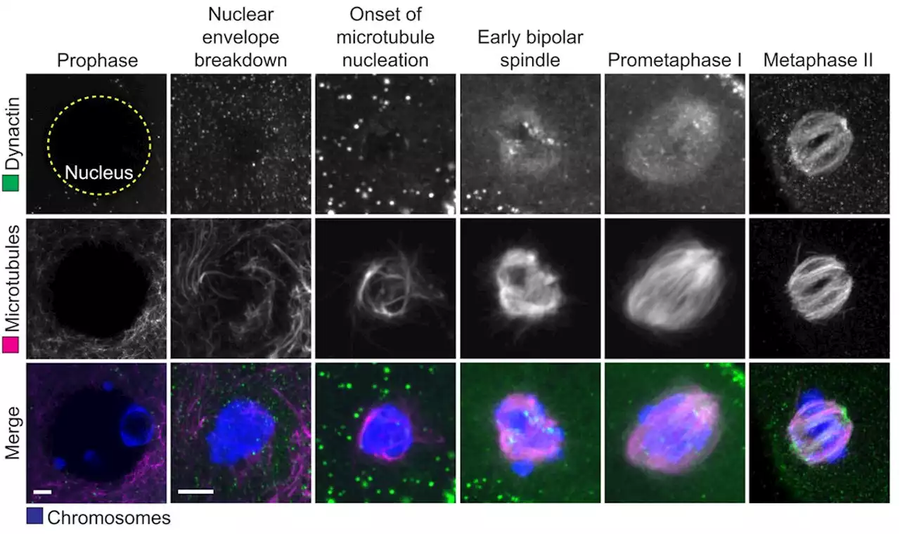 Mechanism of spindle pole organization and instability in human oocytes