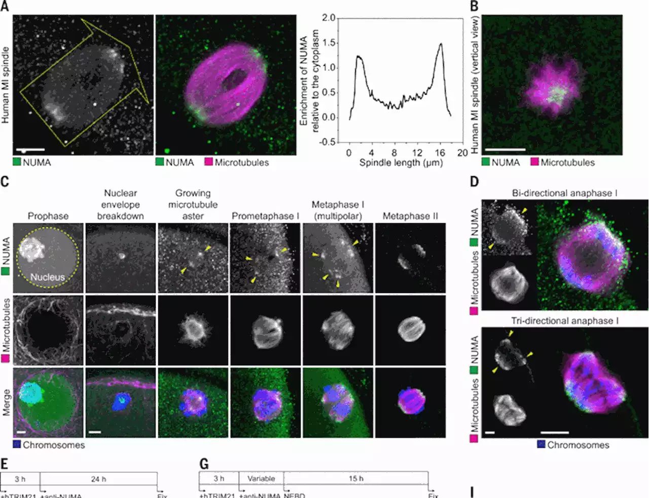 Mechanism of spindle pole organization and instability in human oocytes