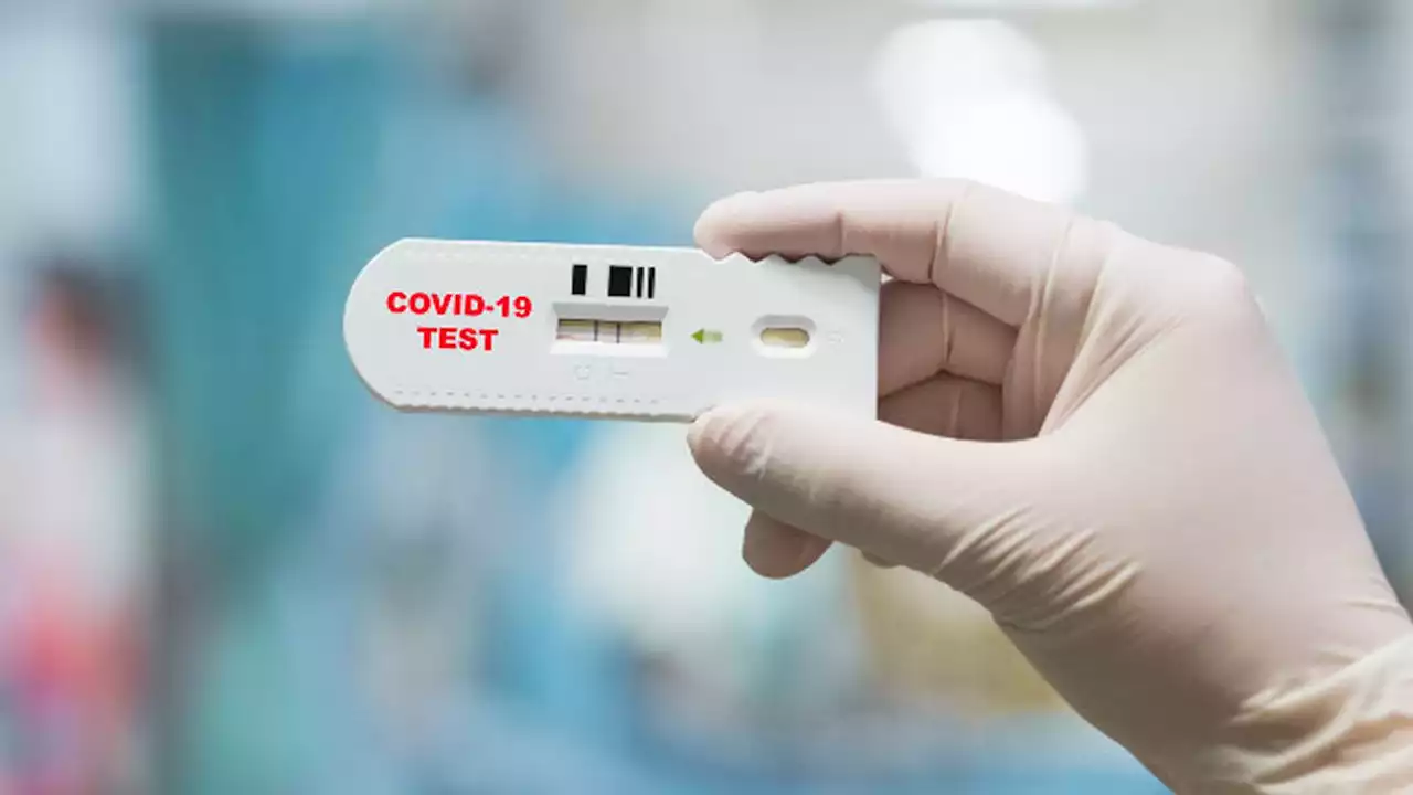 COVID-19 live updates: Weekly global number of cases fell by 19%, WHO says