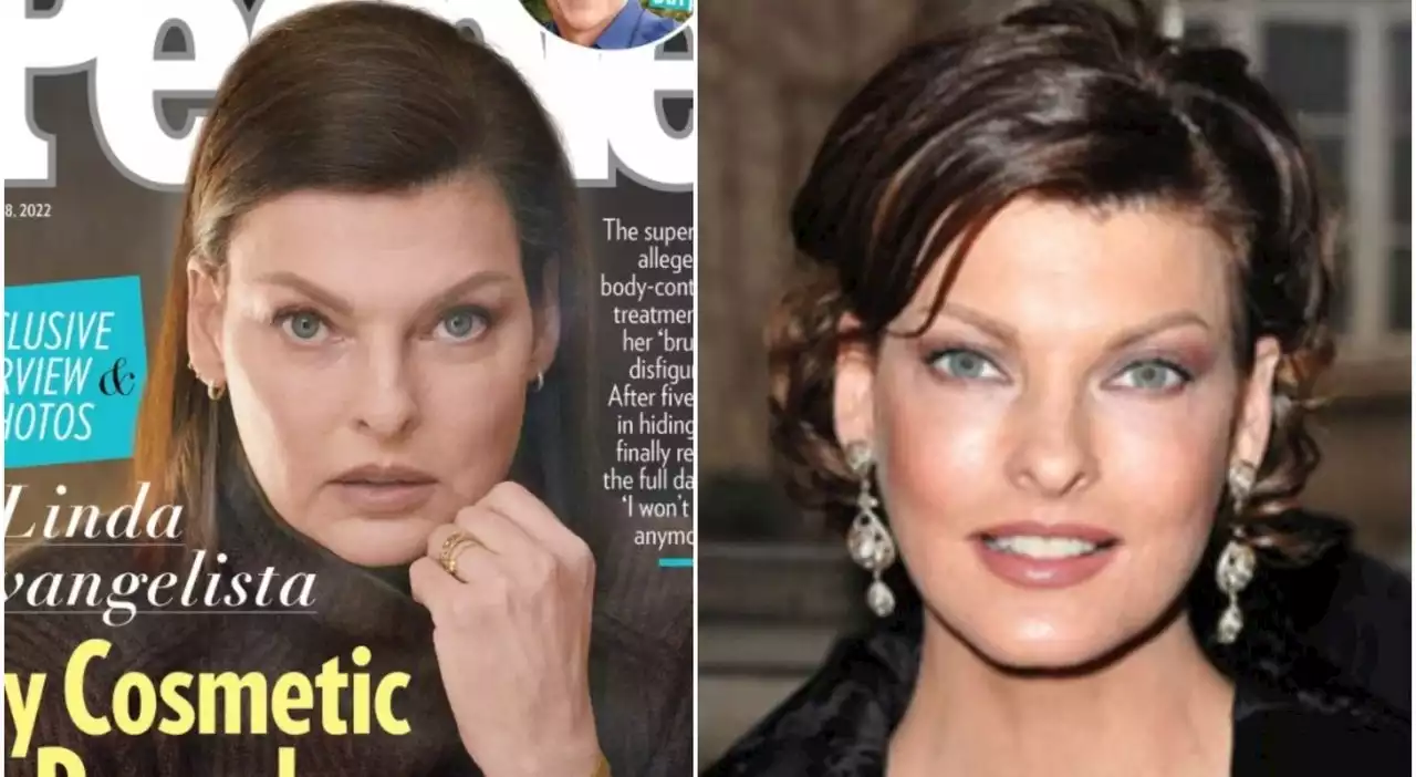 Linda Evangelista, le foto della top model sfigurata dalla chirurgia: «Non mi nascondo più»