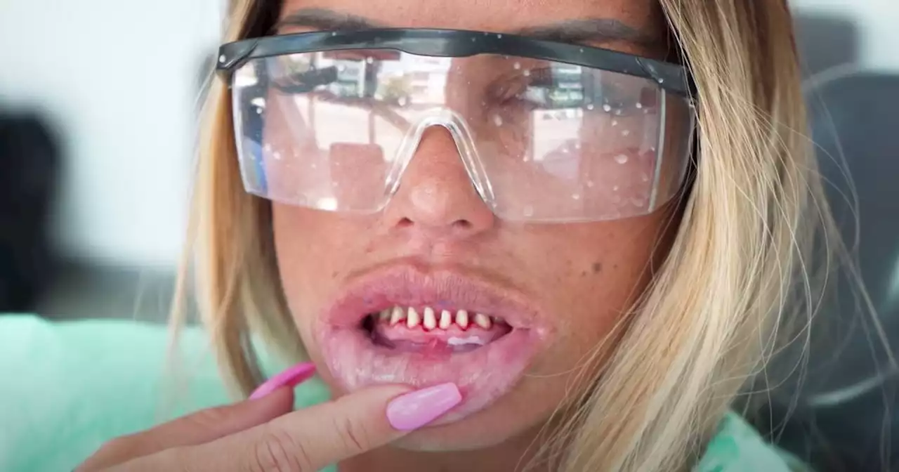 Katie Price's plastic surgery in full - Boob jobs, fillers and fake teeth