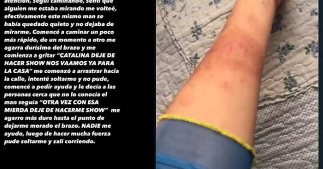 Denuncia en Bogotá: Mujer afirma que desconocido la arrastró del brazo fingiendo pelea de pareja