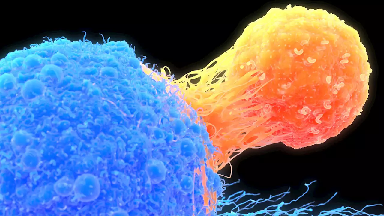 Genetically engineered immune cells have kept two people cancer-free for a decade