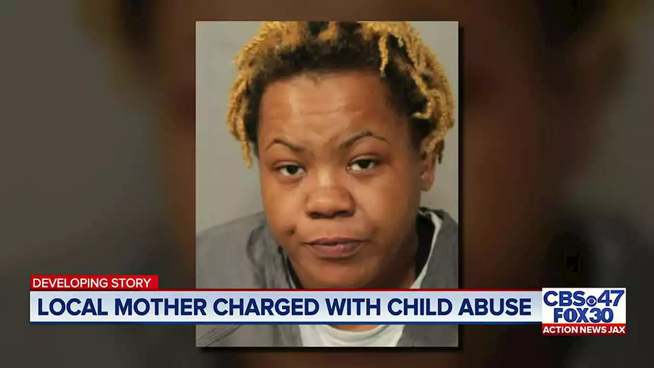 ‘I can’t even believe that kind of thing happened’: Woman arrested, accused of burning child