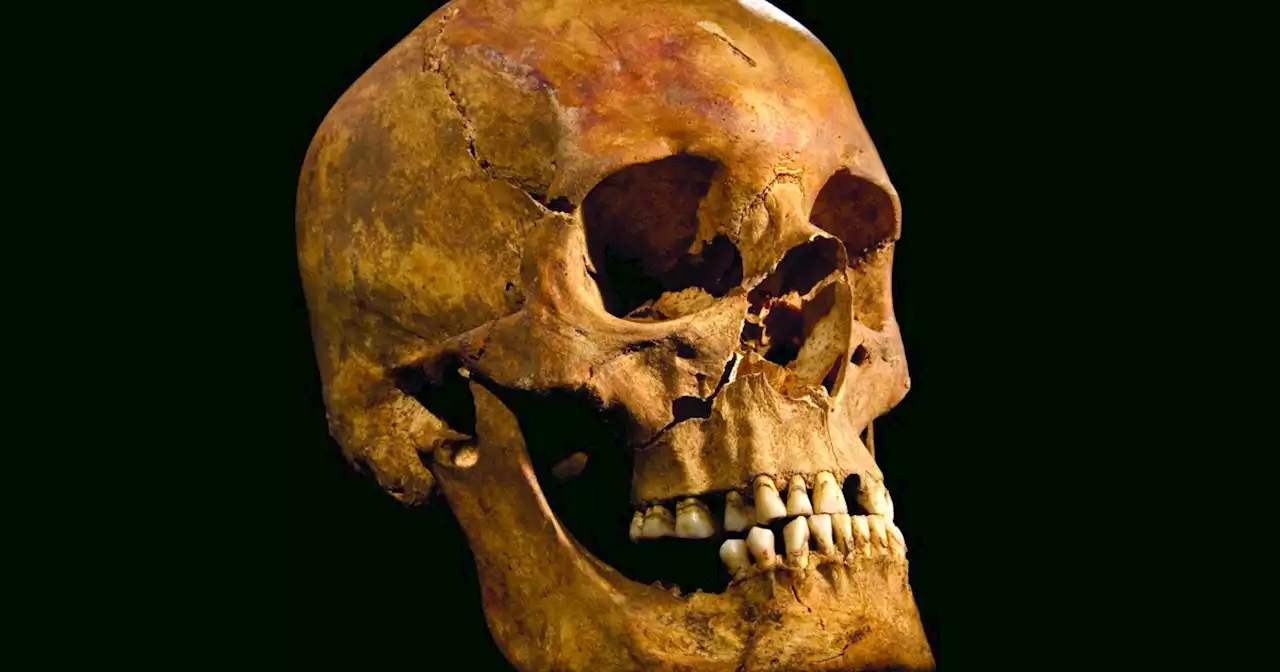 Archaeologists find evidence of first ear surgery on 5,300-year-old skull