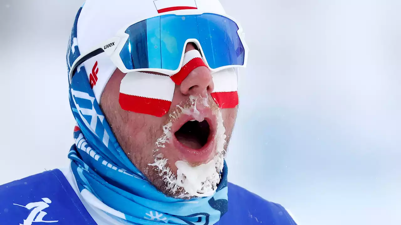 Frost-Beard: Heavy Winds Leave Cross Country Skiers with Facial Hair Freeze