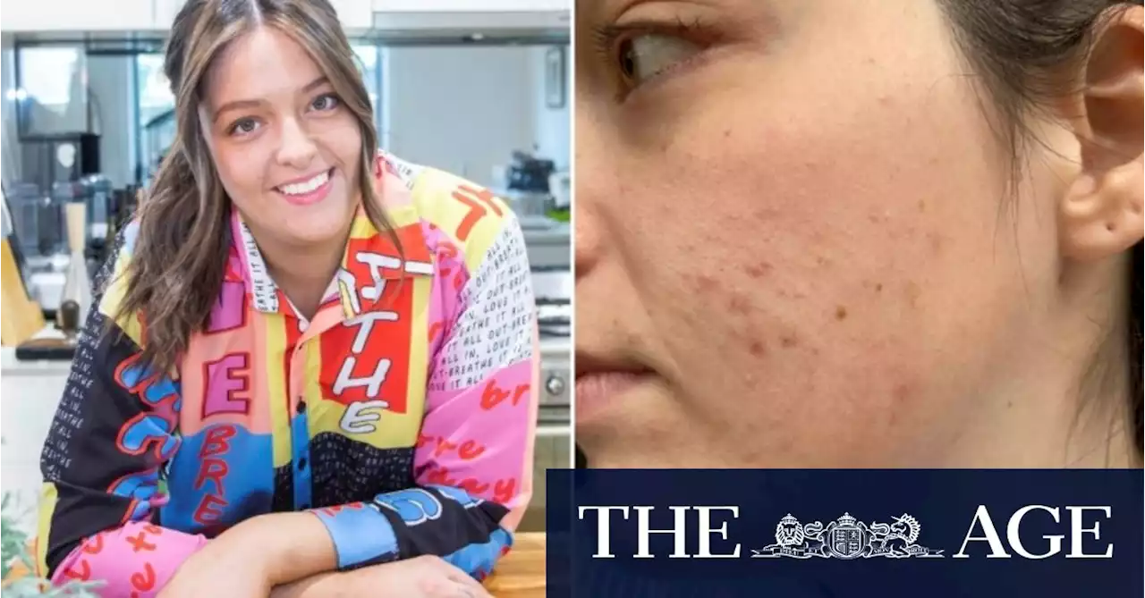 Why the pandemic can affect your skin