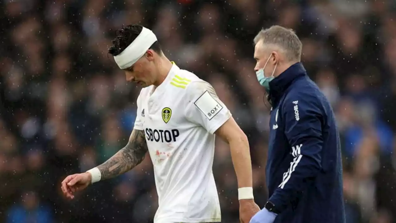No need to dramatise response to Koch head injury, says Bielsa