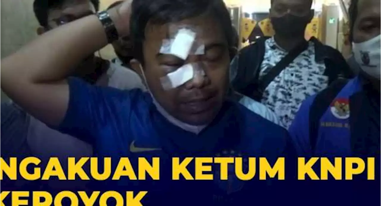 Pengakuan Lengkap Ketum KNPI Dikeroyok Orang Tak Dikenal, Langsung Lapor Polisi!