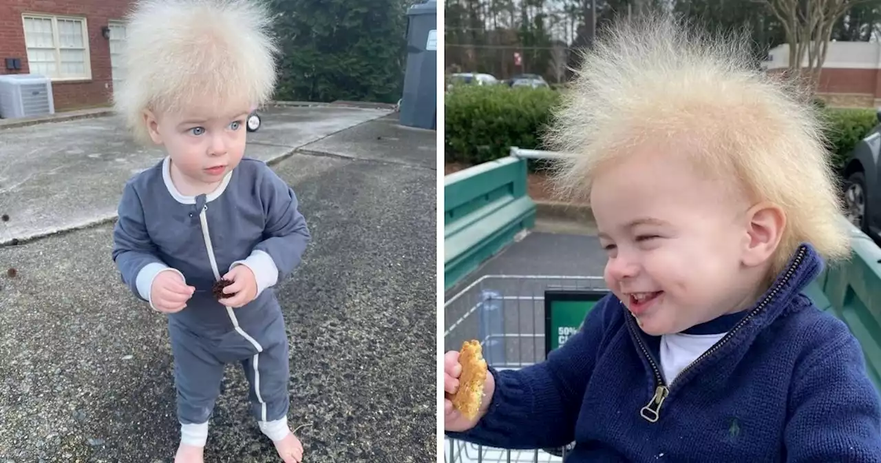 Toddler Diagnosed With Rare Uncombable Hair Syndrome