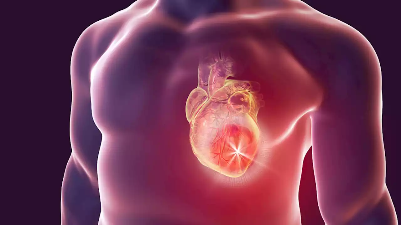 Study finds people who had COVID-19 are at higher risk for heart problems