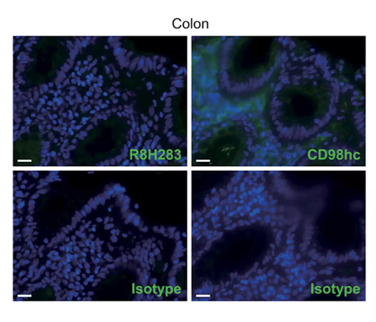 Selective targeting of multiple myeloma cells with a monoclonal antibody recognizing the ubiquitous protein CD98 heavy chain