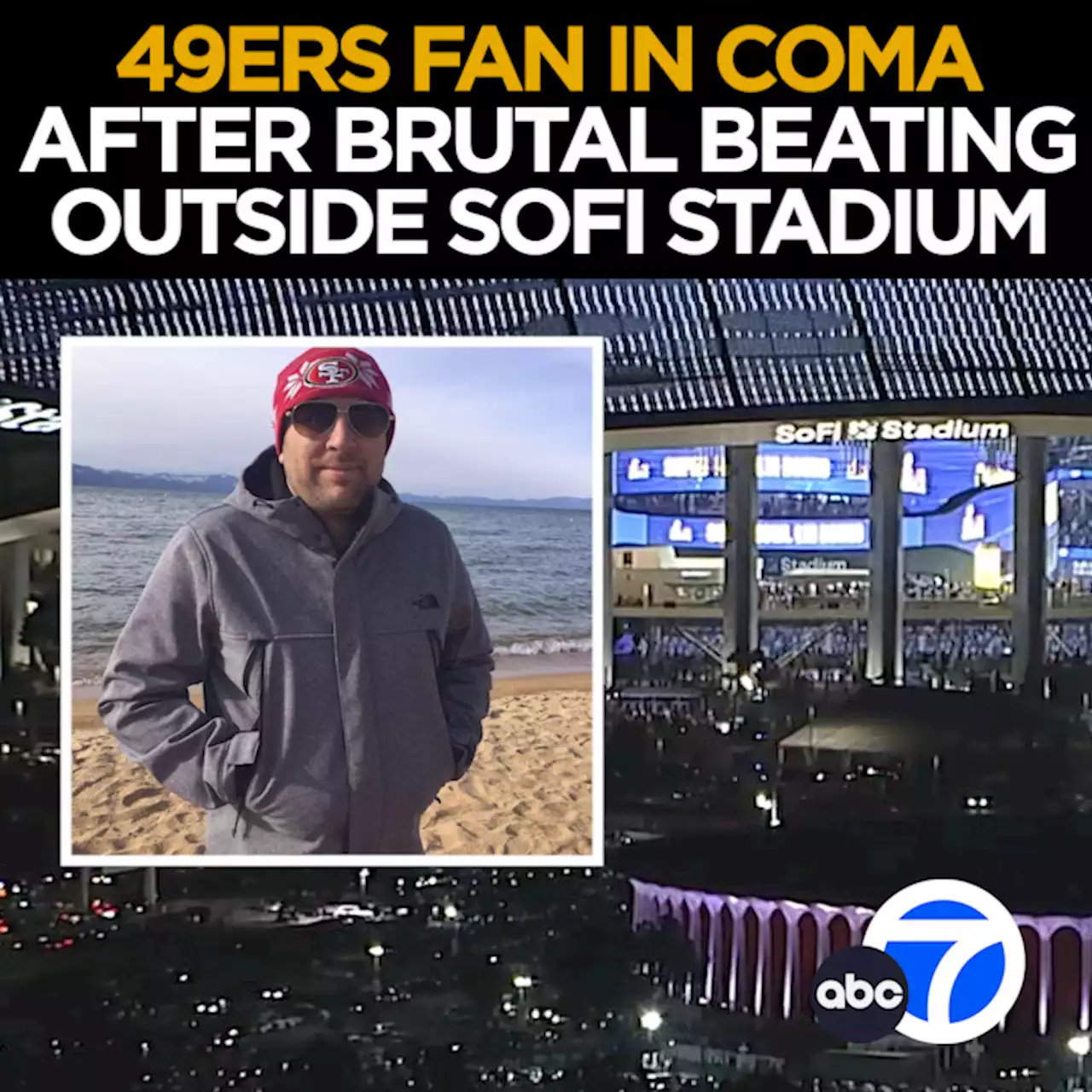 49ers fan in coma after assault outside SoFi Stadium during NFC title game, police say