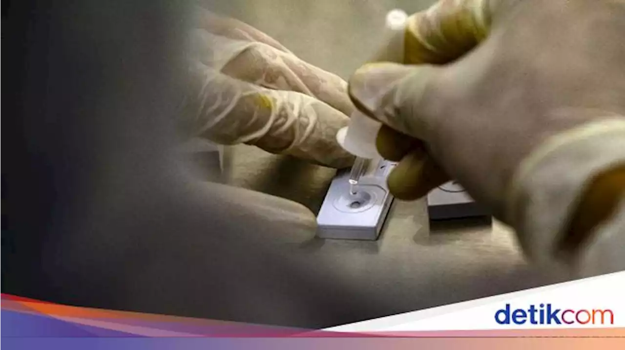 Hasil PCR Positif Keluar Sebelum Tes, Staf Bumame Dapat Teguran Keras