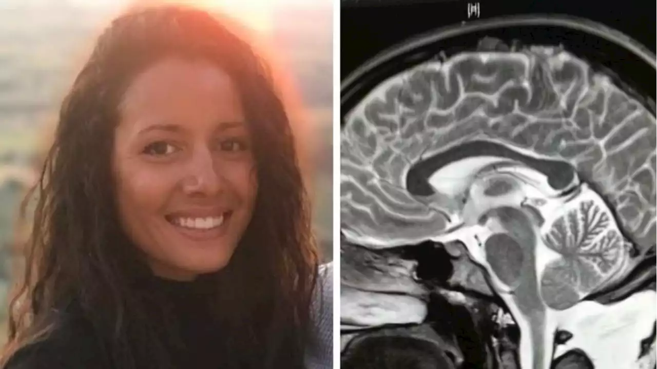 Woman’s brain ‘slips’ into spine, collapses 20 times a day