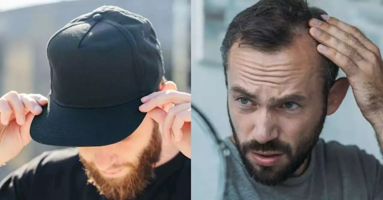 Por qué usar gorra es malo para las personas que se le está cayendo el cabello