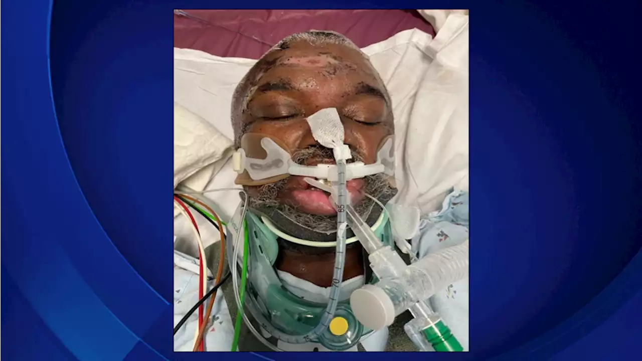 Help Needed To Identify Man Severely Injured In South LA Hit-And-Run