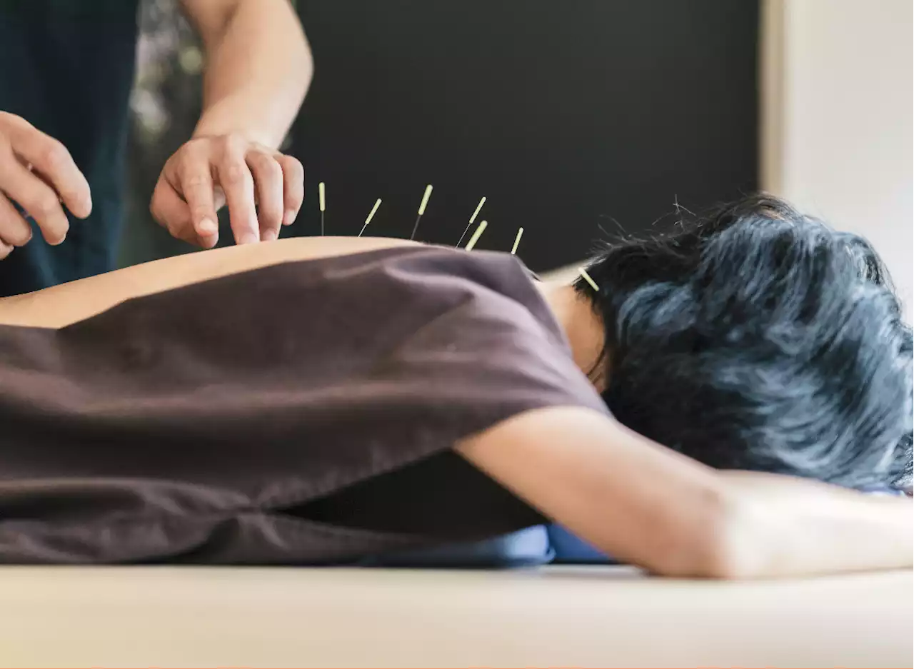 Here's How Acupuncture Can Improve Your Gut Health, Expert Says — Eat This Not That