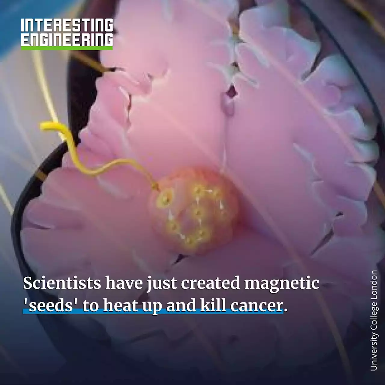 Scientists just created magnetic 'seeds' to heat up and kill cancer